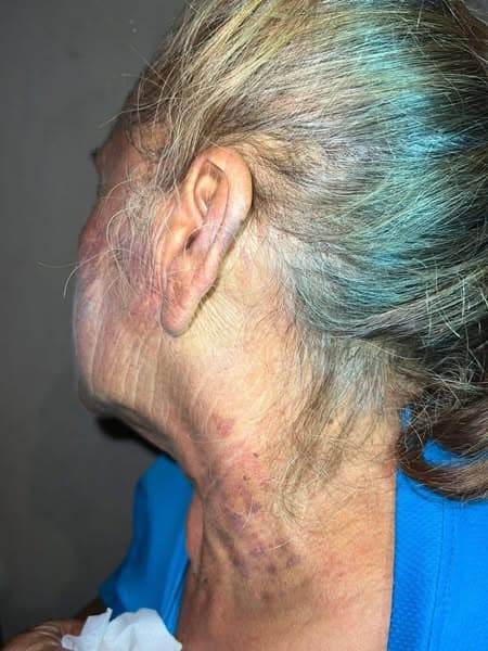 Recapturan a hombre acusado de agredir a su madre; incumplió medidas judiciales