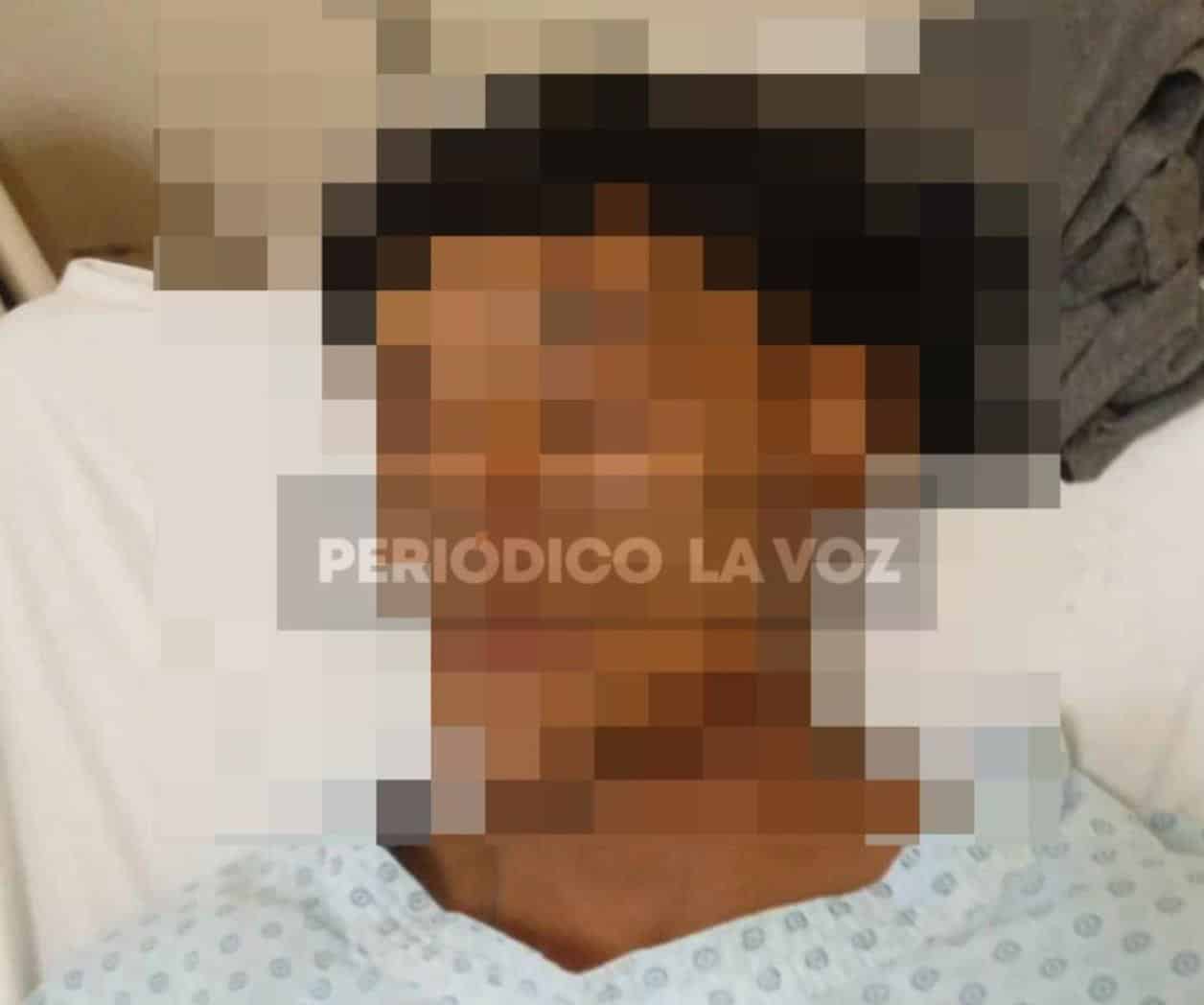 Joven de 18 años sufre fractura de mandíbula en ataque en Nueva Rosita