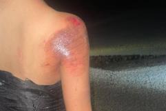 Vive Angela violento episodio durante vacaciones en Palaú