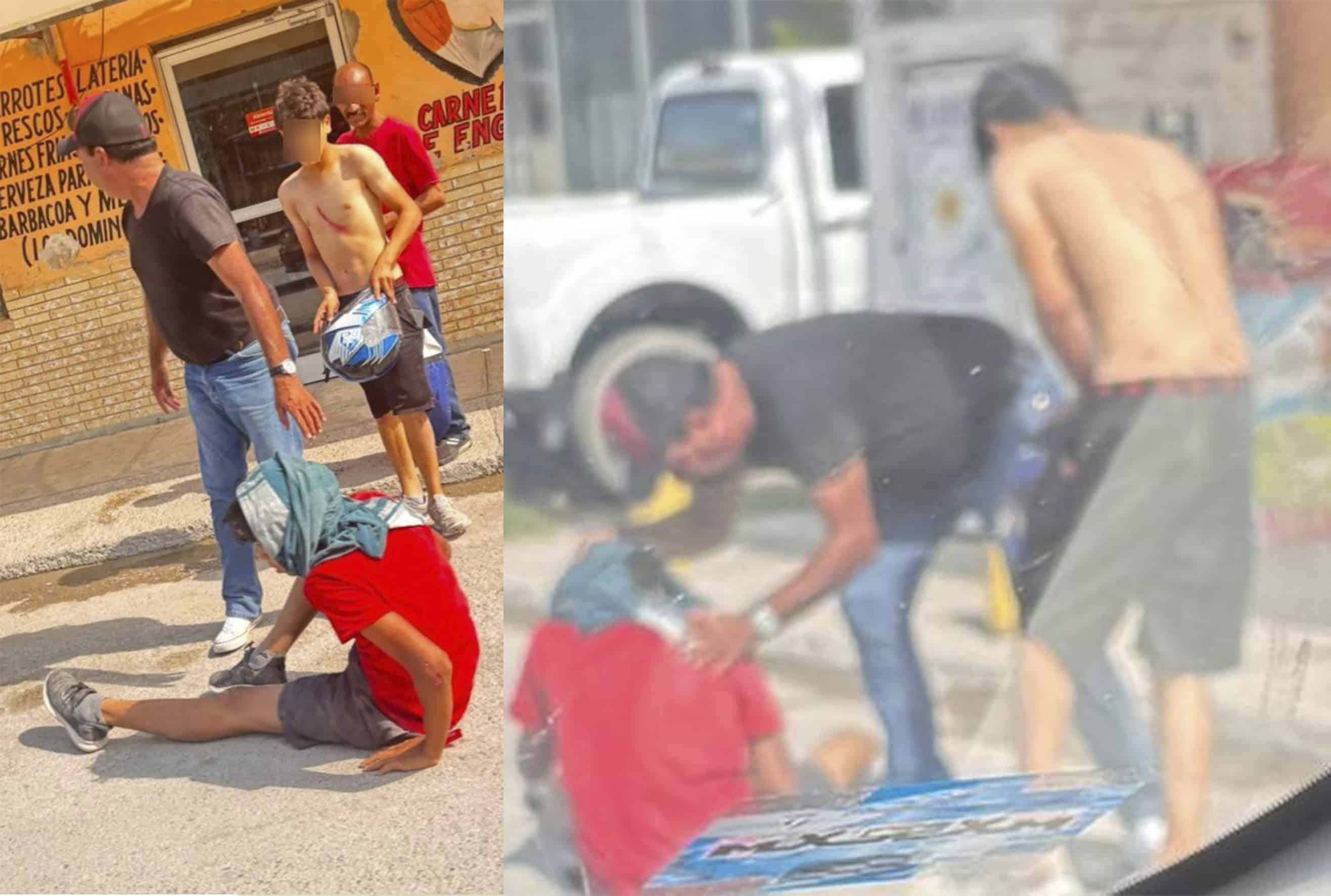 Ciclista resulta lesionado tras ser impactado por taxi en Allende