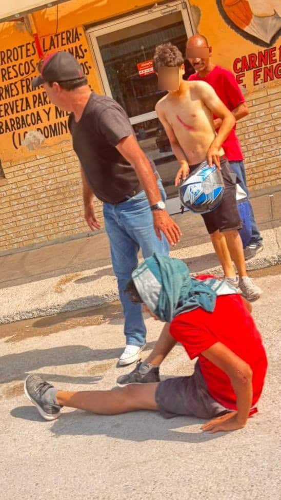 Ciclista resulta lesionado tras ser impactado por taxi en Allende