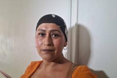 Pacientes con cáncer en México luchan por recursos y tratamiento