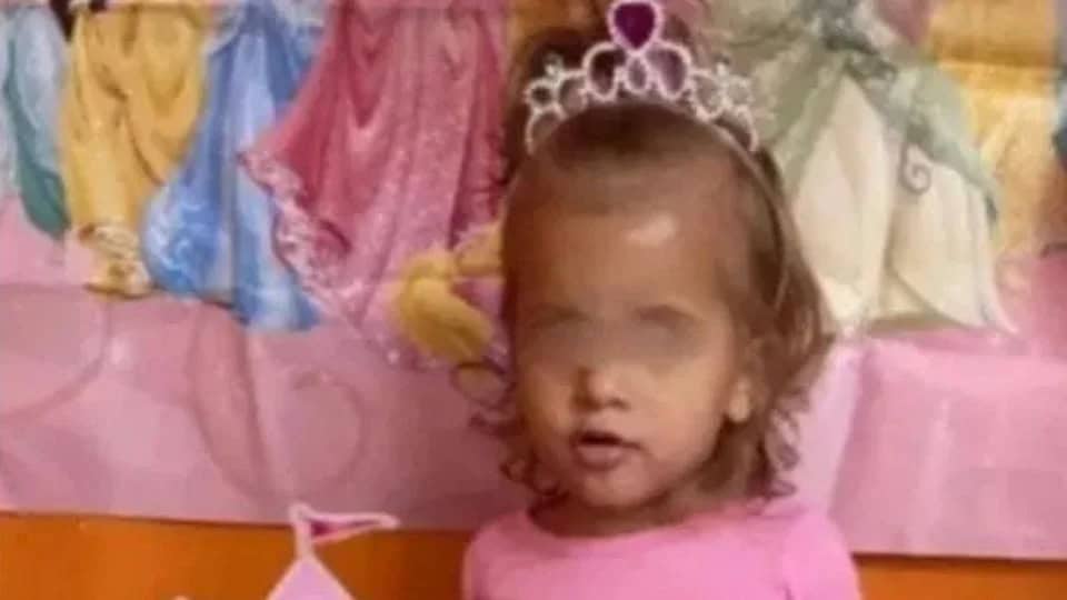 Tragedia en Dover Township: pit bull ataca mortalmente a niña de un año