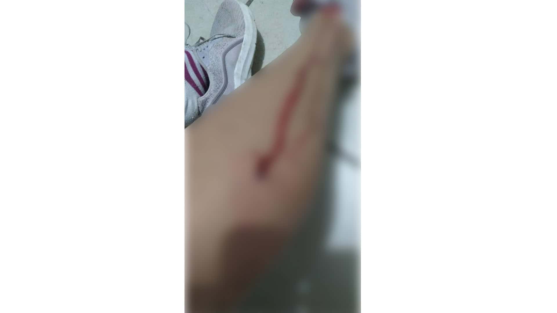Peligro en la Zona Centro: Vecinos alertan sobre agresiones de perros callejeros