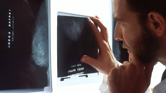 Nuevo medicamento contra el cáncer elimina tumores agresivos