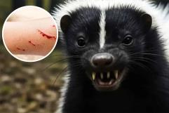 Zacatecas confirma primer caso de rabia humana en casi 40 años