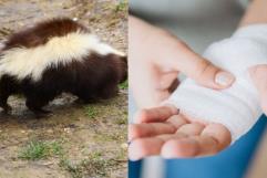 Joven de 17 años muere en Zacatecas tras rabia por mordedura de zorrillo