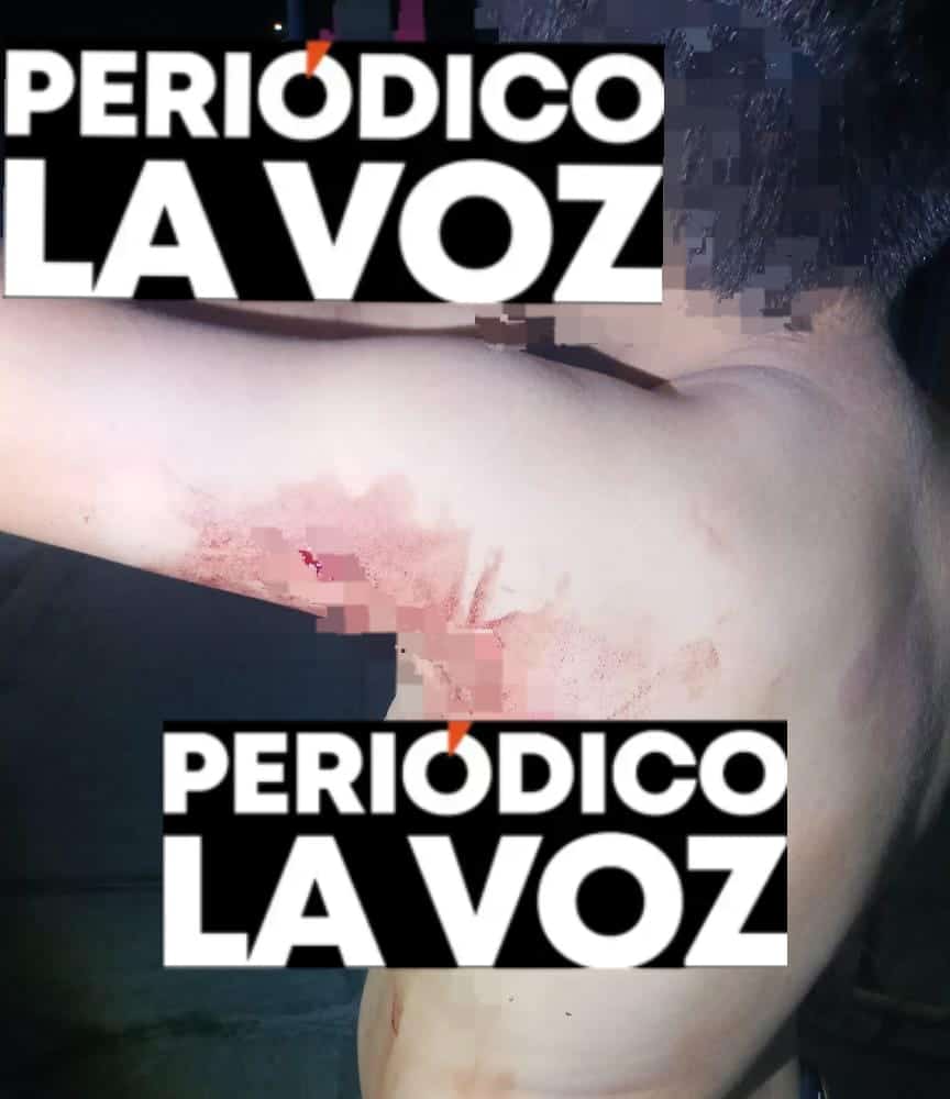 Niño de 10 años herido en riña entre menores en Monclova