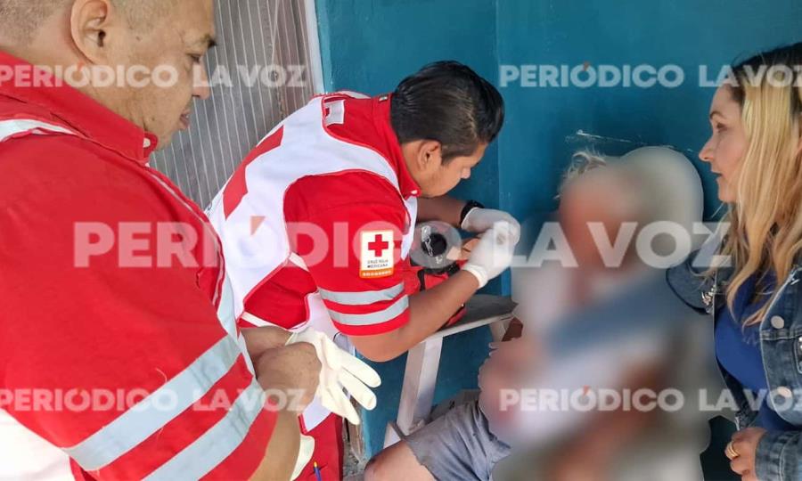Hombre de 79 años se lesiona al caer de una escalera en Monclova