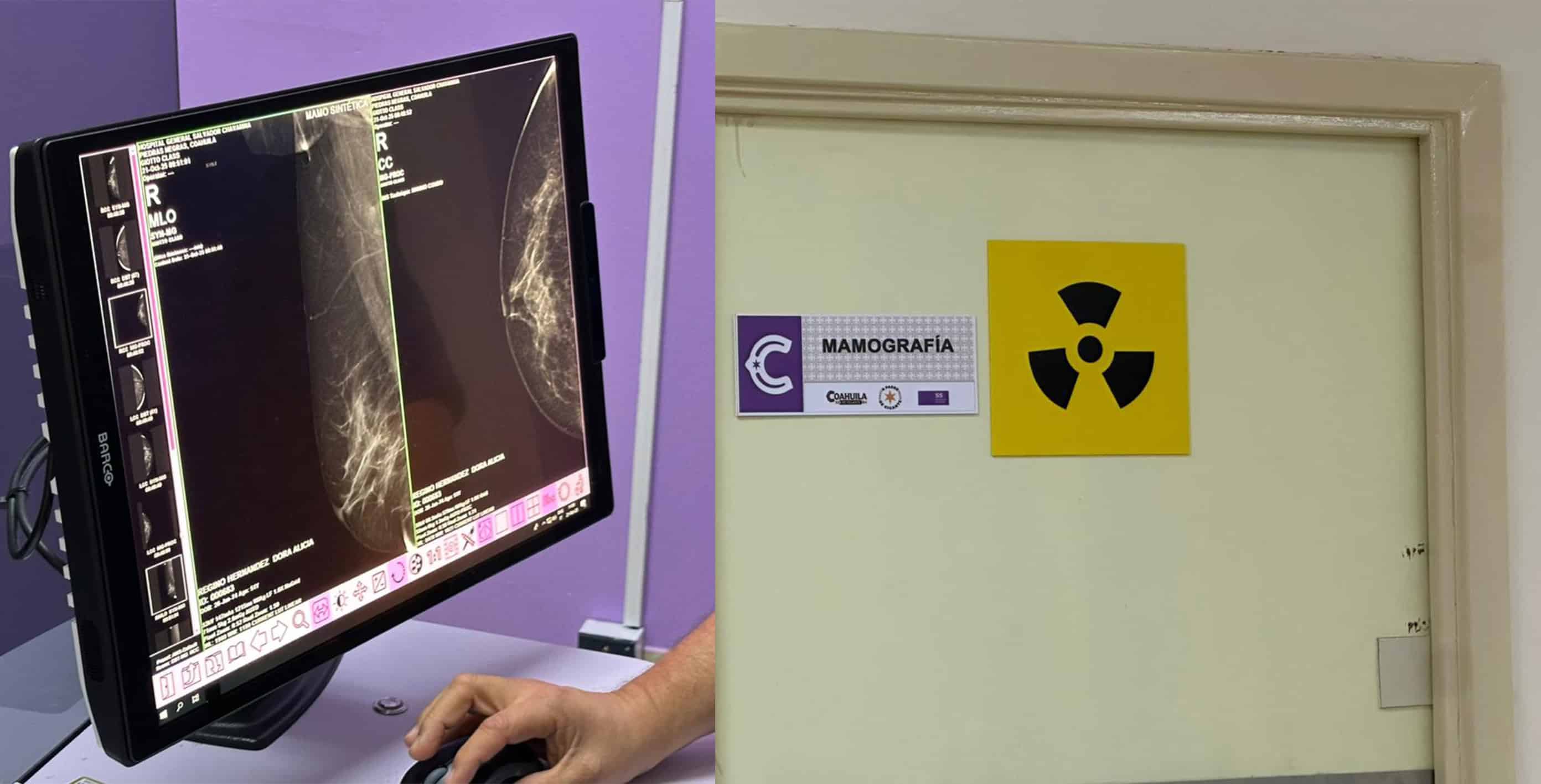 Siguen mastografías tras cierre de campaña de octubre en el Hospital Chavarría