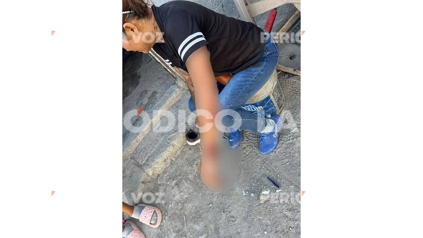 Mujer gravemente herida en Monclova tras ataque con navaja