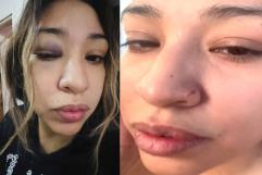 Mujer denuncia agresión física de su pareja ante la indiferencia de las autoridades