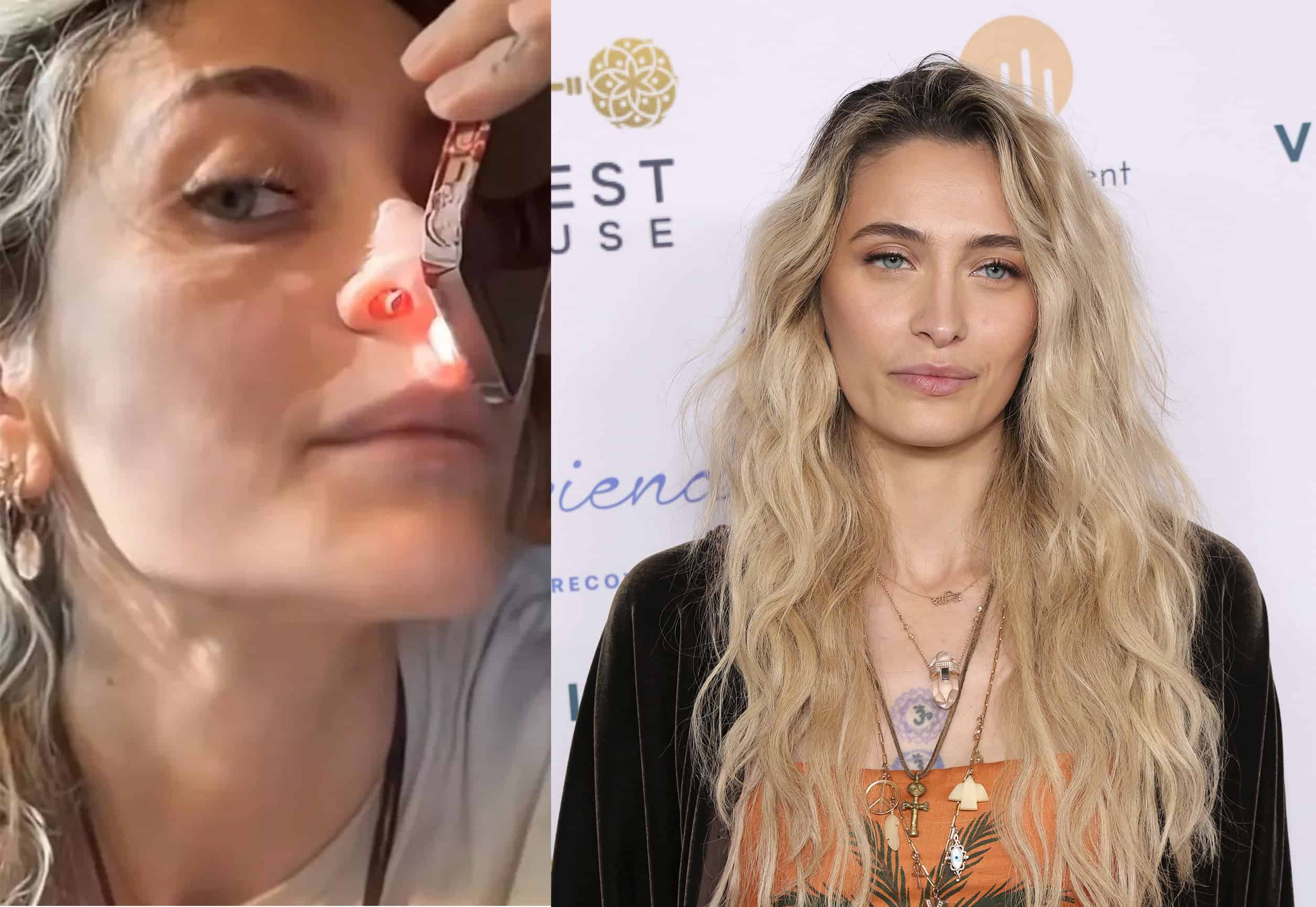 Paris, hija de Michael Jackson, confiesa que el consumo de drogas le perforó el tabique nasal