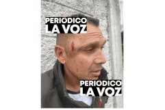 Delincuente golpeado con bate de béisbol en Castaños tras intento de robo