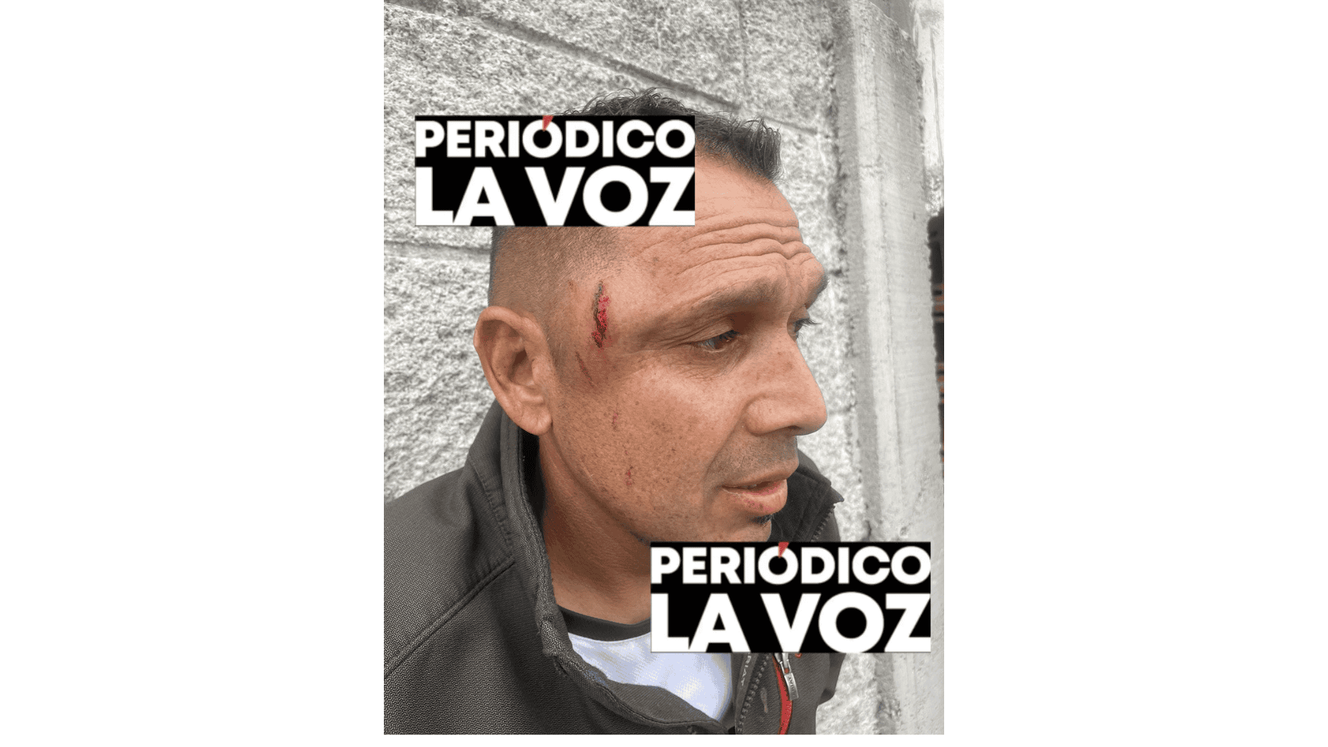 Delincuente golpeado con bate de béisbol en Castaños tras intento de robo