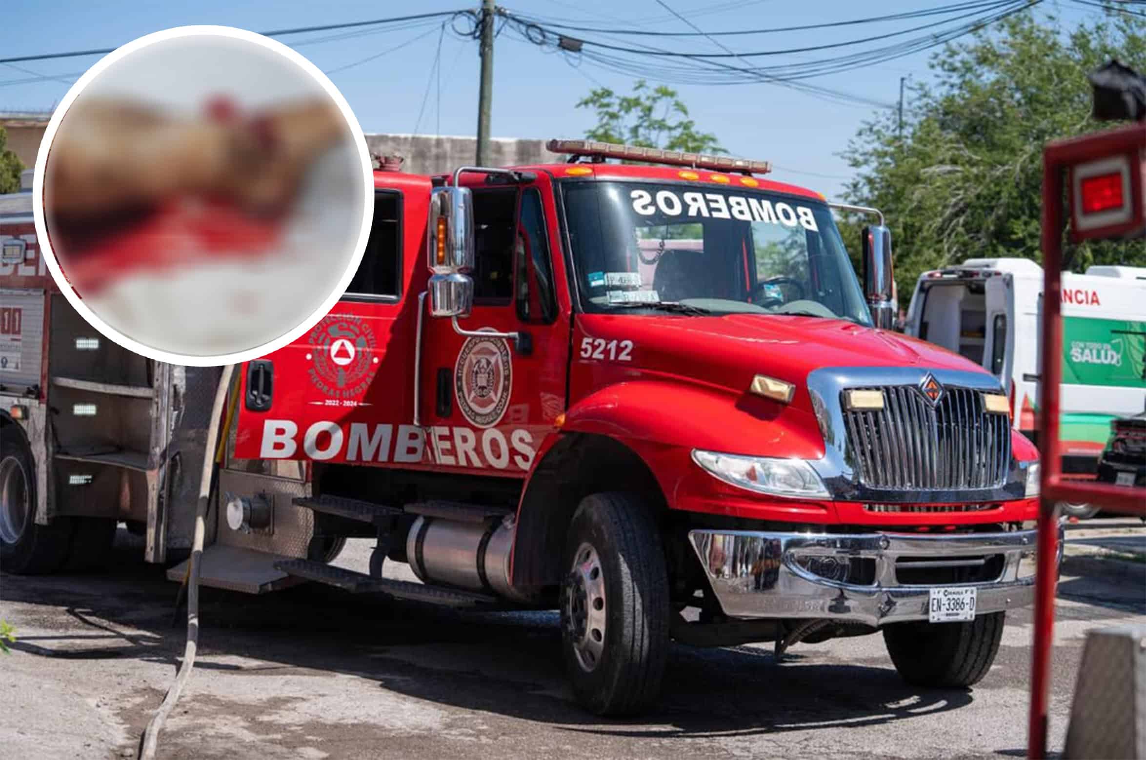 Acusan negligencia en Nava: mujer podría perder una pierna tras incidente con Bomberos