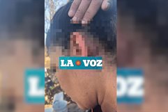 En Múzquiz  mujer resulta herida por su ex tras ataque con machete