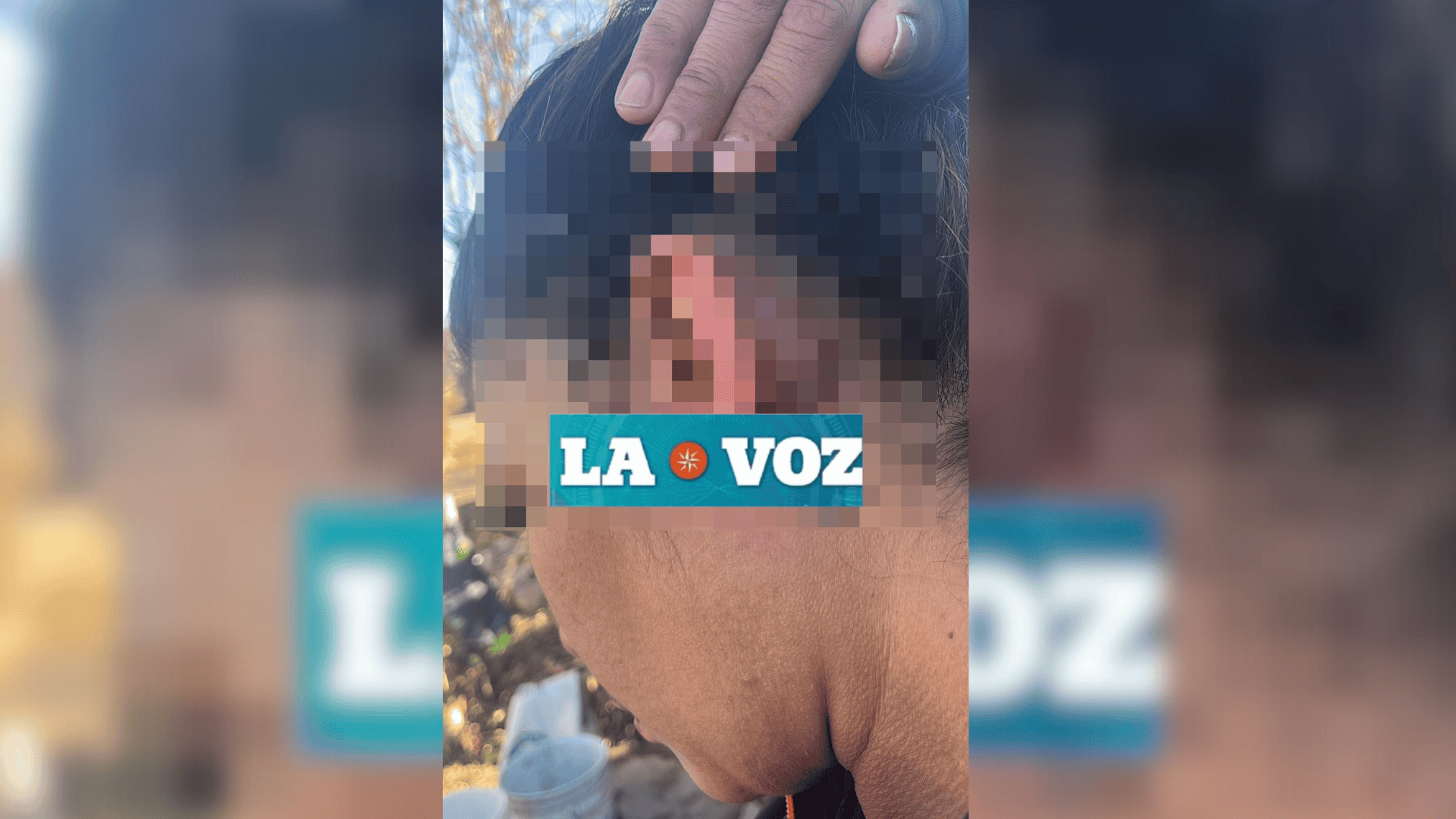 En M&uacute;zquiz  mujer resulta herida por su ex tras ataque con machete