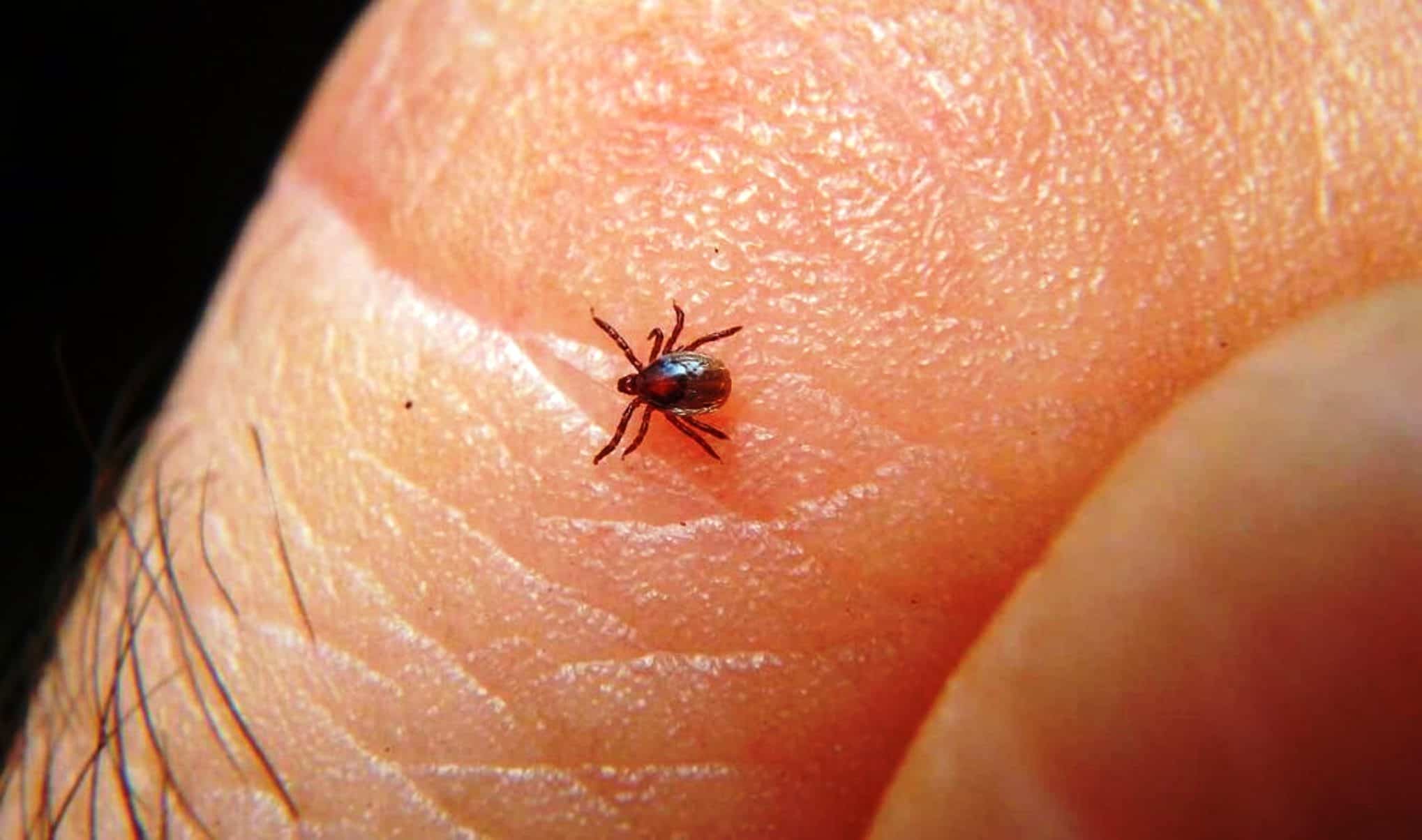 Rickettsia en Coahuila: diputada Fraustro D&aacute;vila demanda acci&oacute;n preventiva