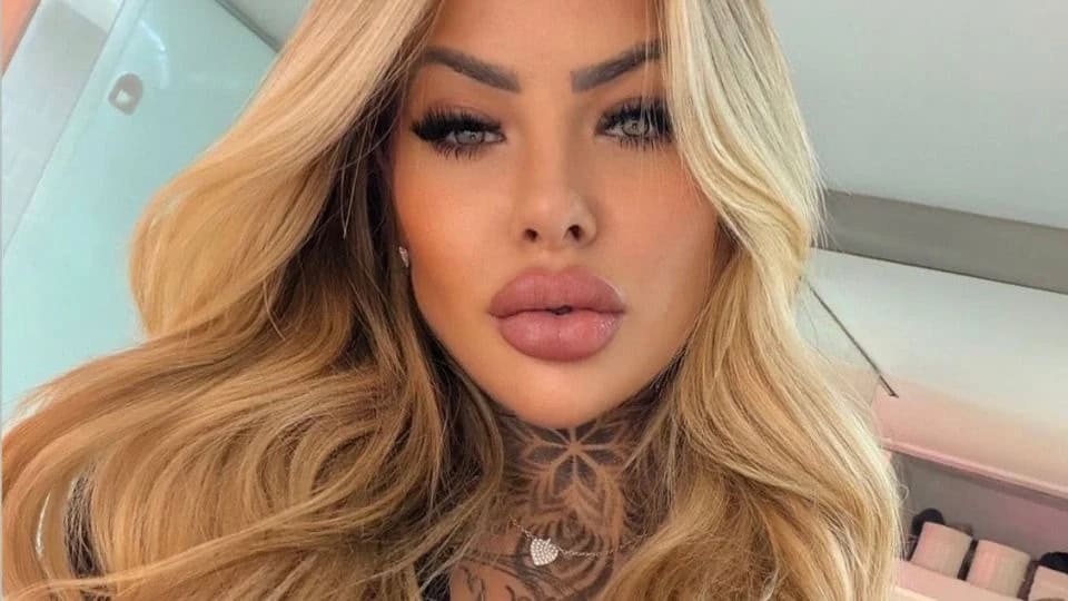 Fallece influencer latina tras cirug&iacute;a est&eacute;tica en Brasil