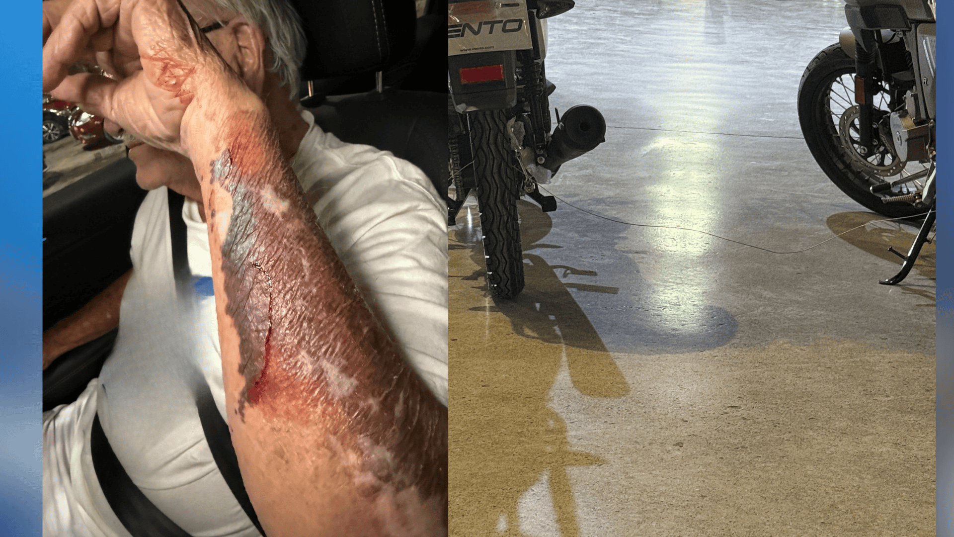 Adulto mayor se lesiona tras caer por cable acerado en City Club Monclova