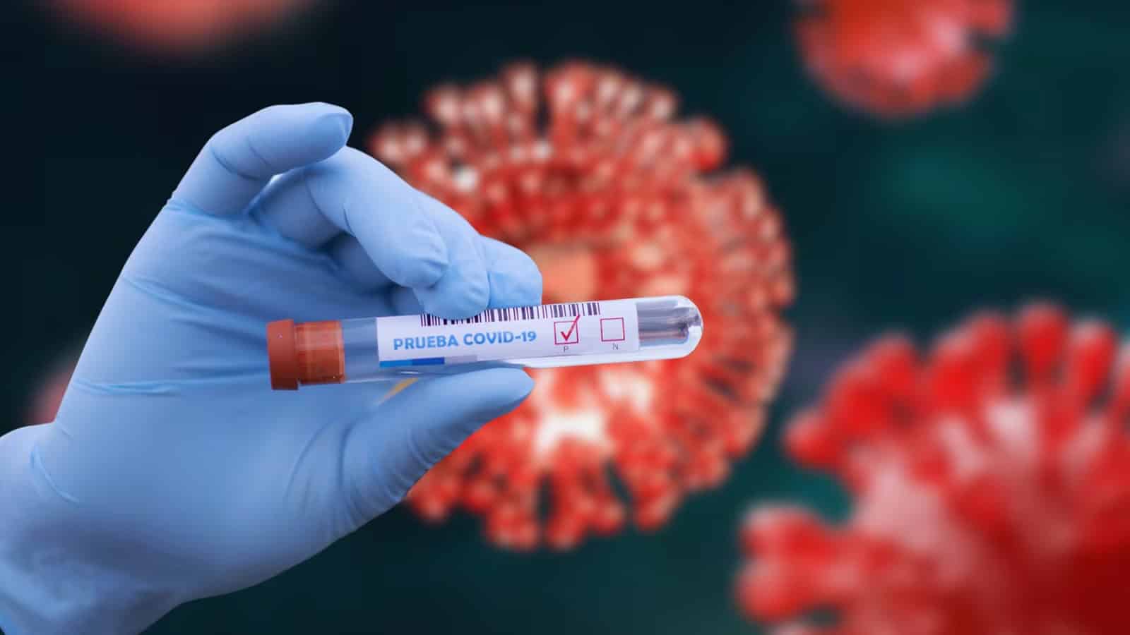 Alertan por &acute;Cigarra&acute;, nueva variante de COVID-19 bajo vigilancia internacional