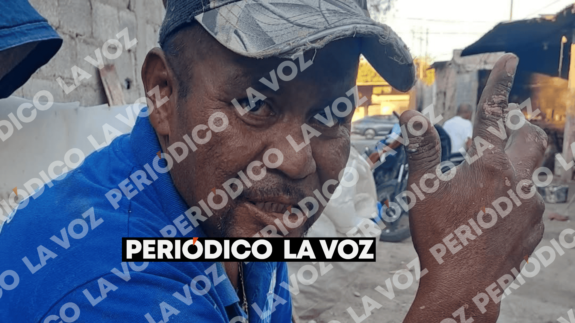 La dura historia de "El Beto", marcada por la lucha, la enfermedad y el abandono