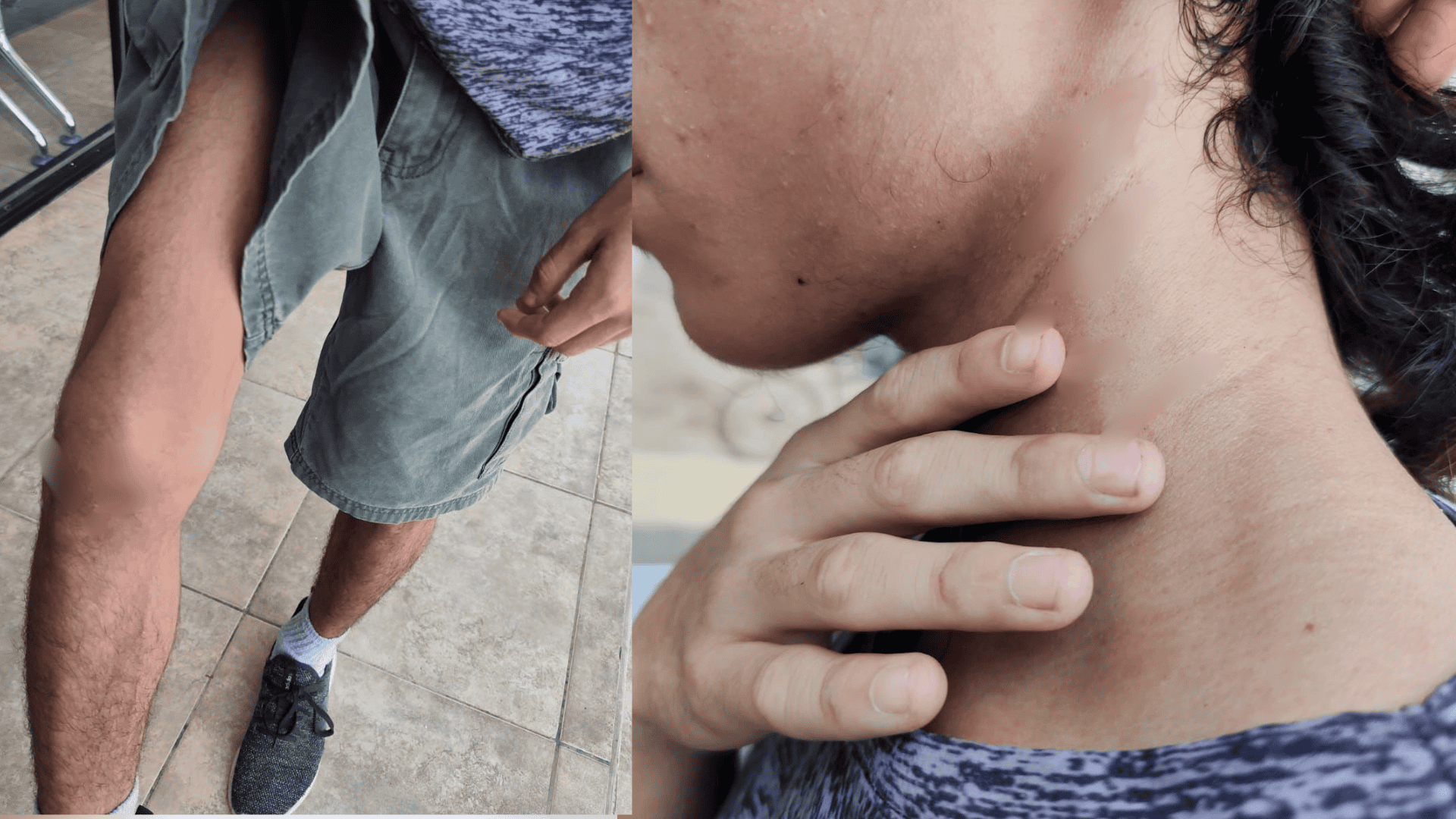Joven denuncia agresi&oacute;n y robo en barrio La Piedra