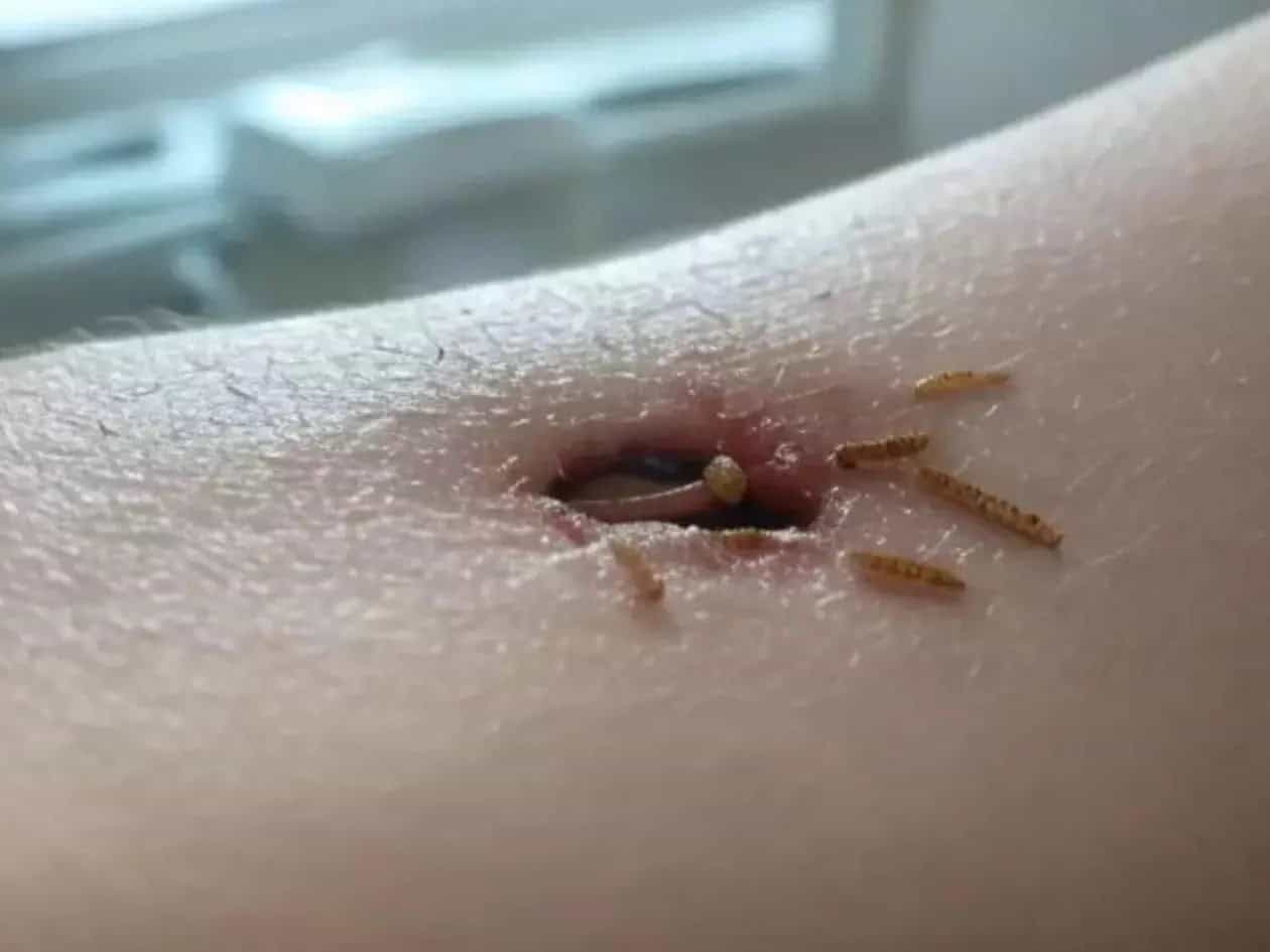 Salud advierte sobre infestaci&oacute;n de gusano barrenador en Coahuila