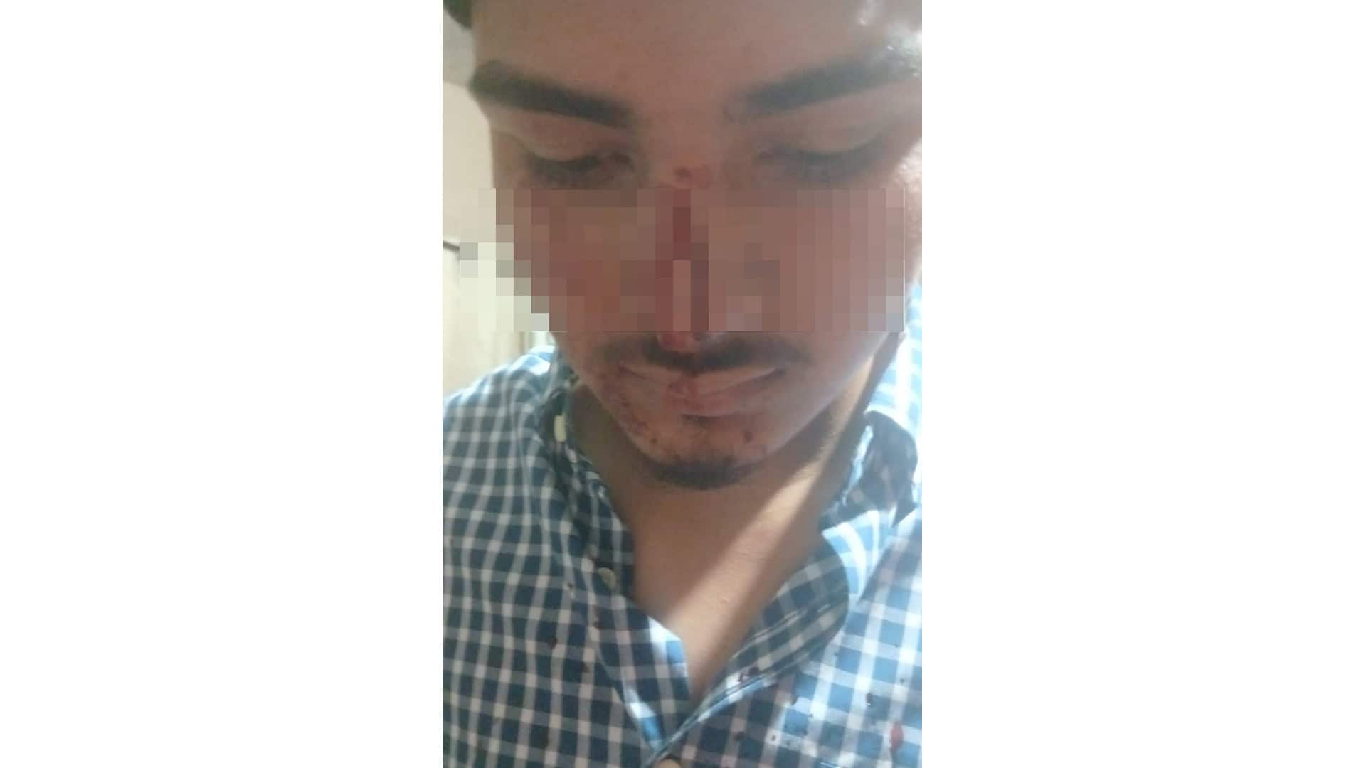 Melchor M&uacute;zquiz: joven sufre agresi&oacute;n en barrio Fundadores