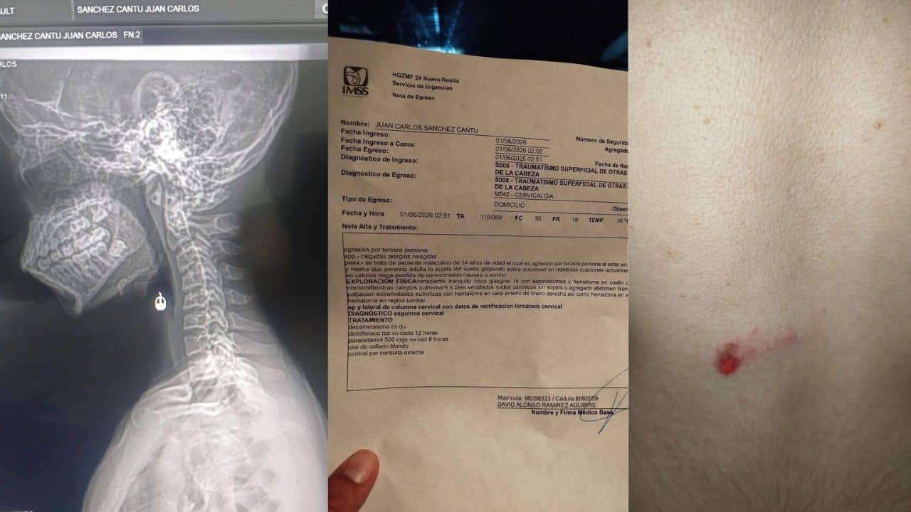 Denuncia a funcionario por golpear a su menor hijo