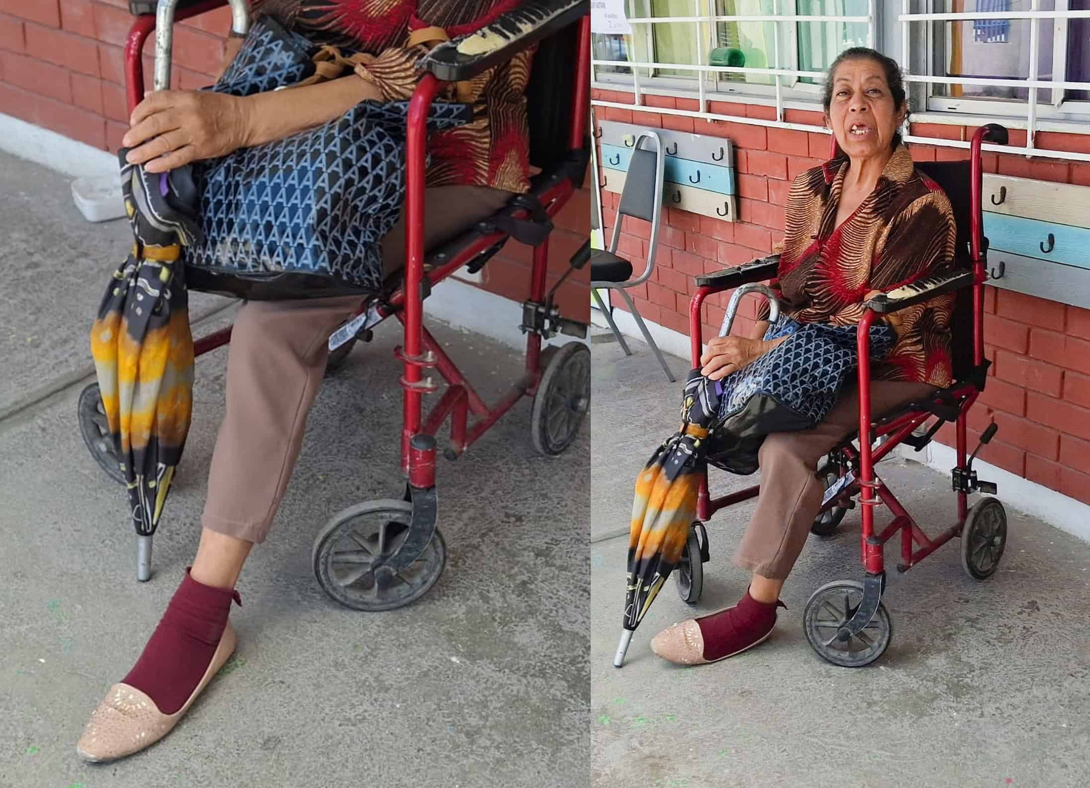 Celemania: la explosi&oacute;n que le arrebat&oacute; la pierna y le apag&oacute; la vista