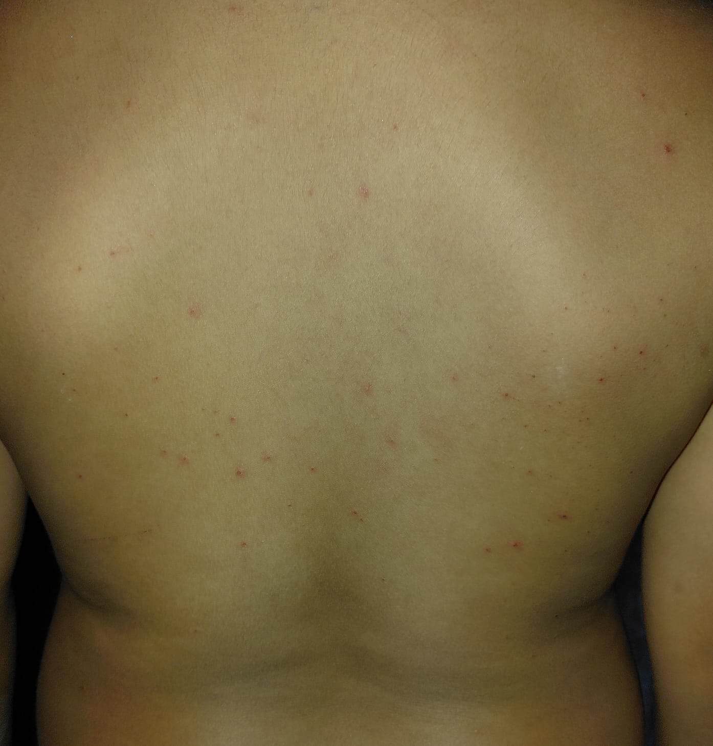 Preocupaci&oacute;n por pulgas y garrapatas en la escuela H&eacute;roes del 47