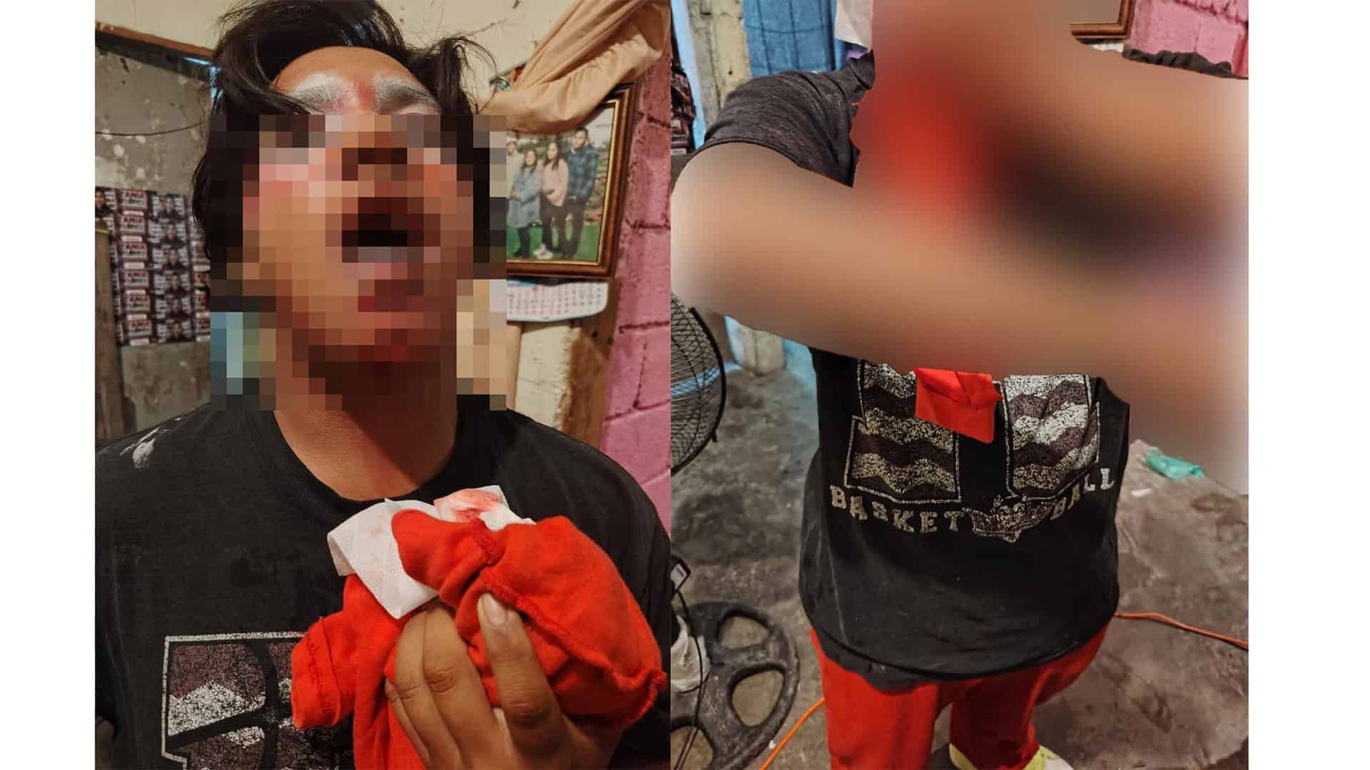 "Payaso Parritas" y su  hijo resultan heridos
