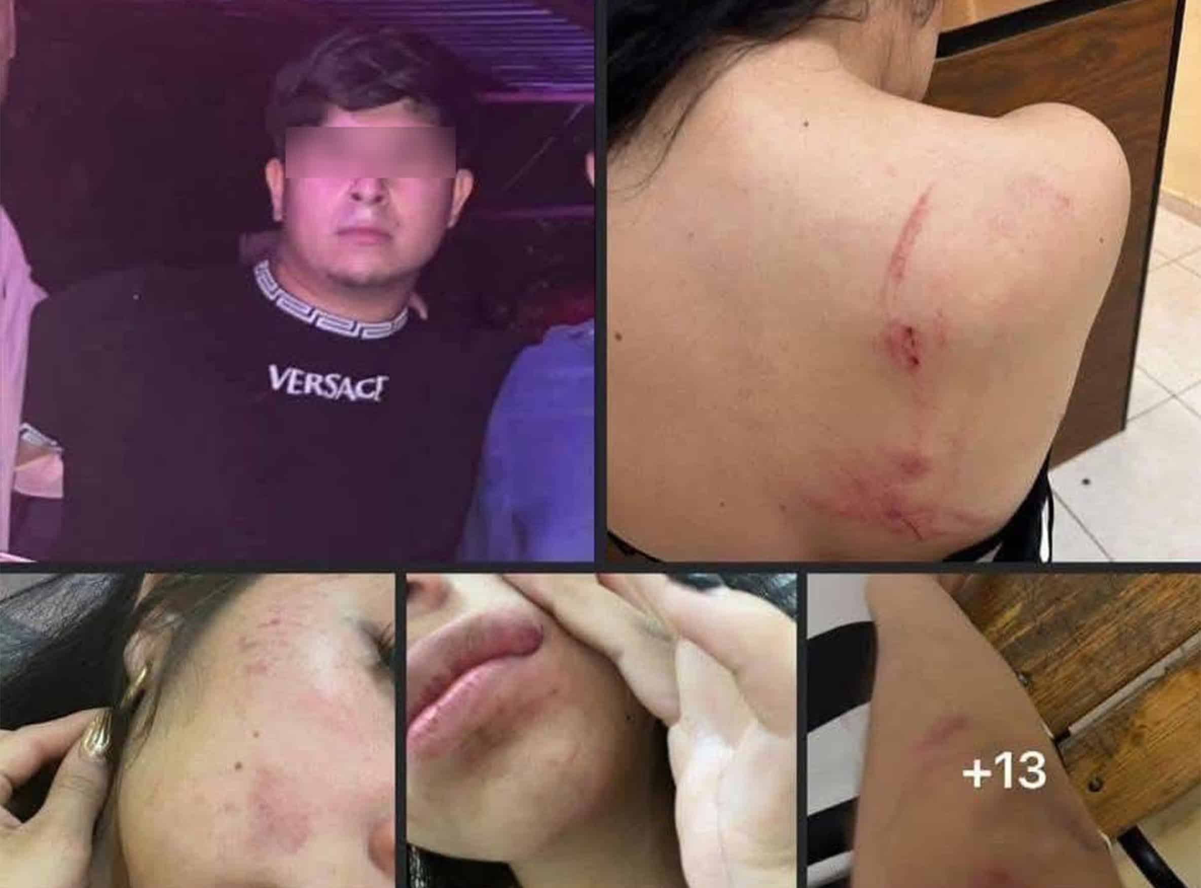 Salen a la luz antecedentes del joven acusado del feminicidio de su madre en Acu&ntilde;a