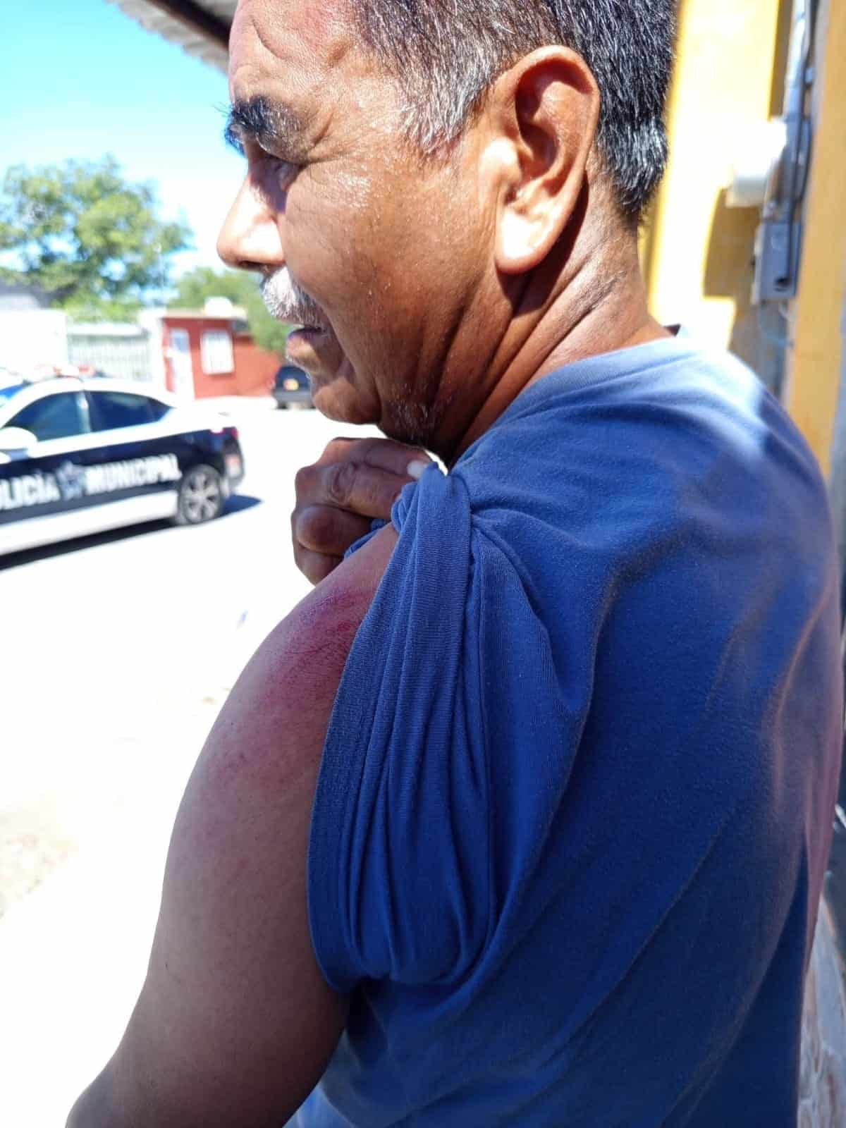 Lo atropella y huye