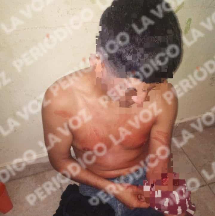 Fuga de Diego N revela agresiones en centro de rehabilitaci&oacute;n Cadeli