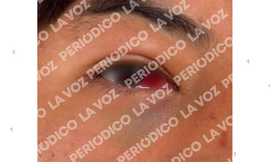Acusan agresión contra menor