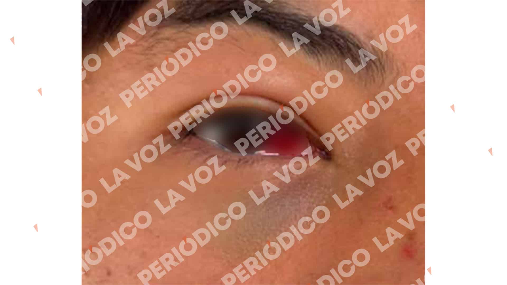 Acusan agresi&oacute;n contra menor
