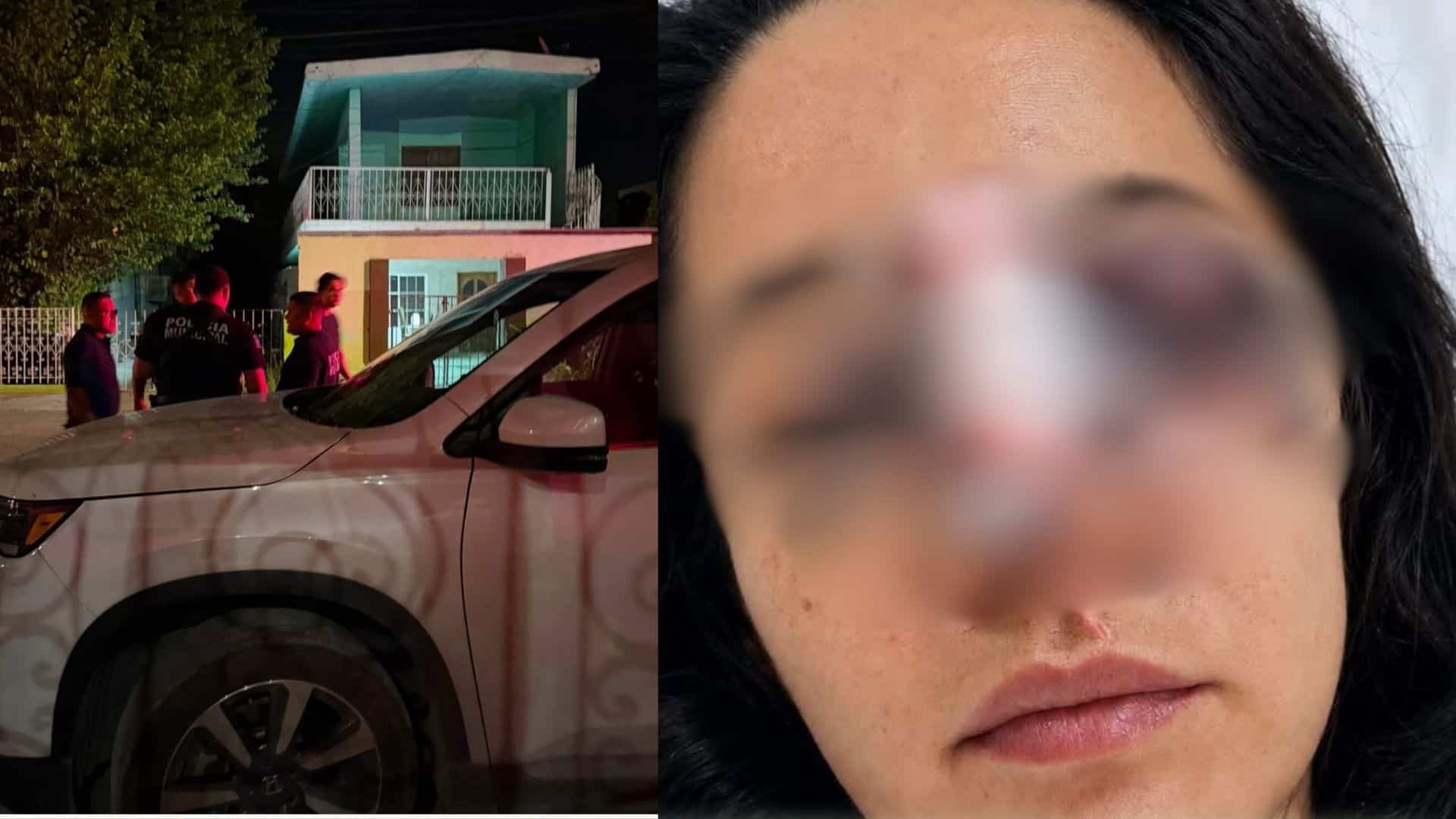 Intentaba sustraer a su hija a la fuerza y terminó lesionada por su actual pareja Intentaba sustraer a su hija a la fuerza y terminó lesionada por su actual pareja