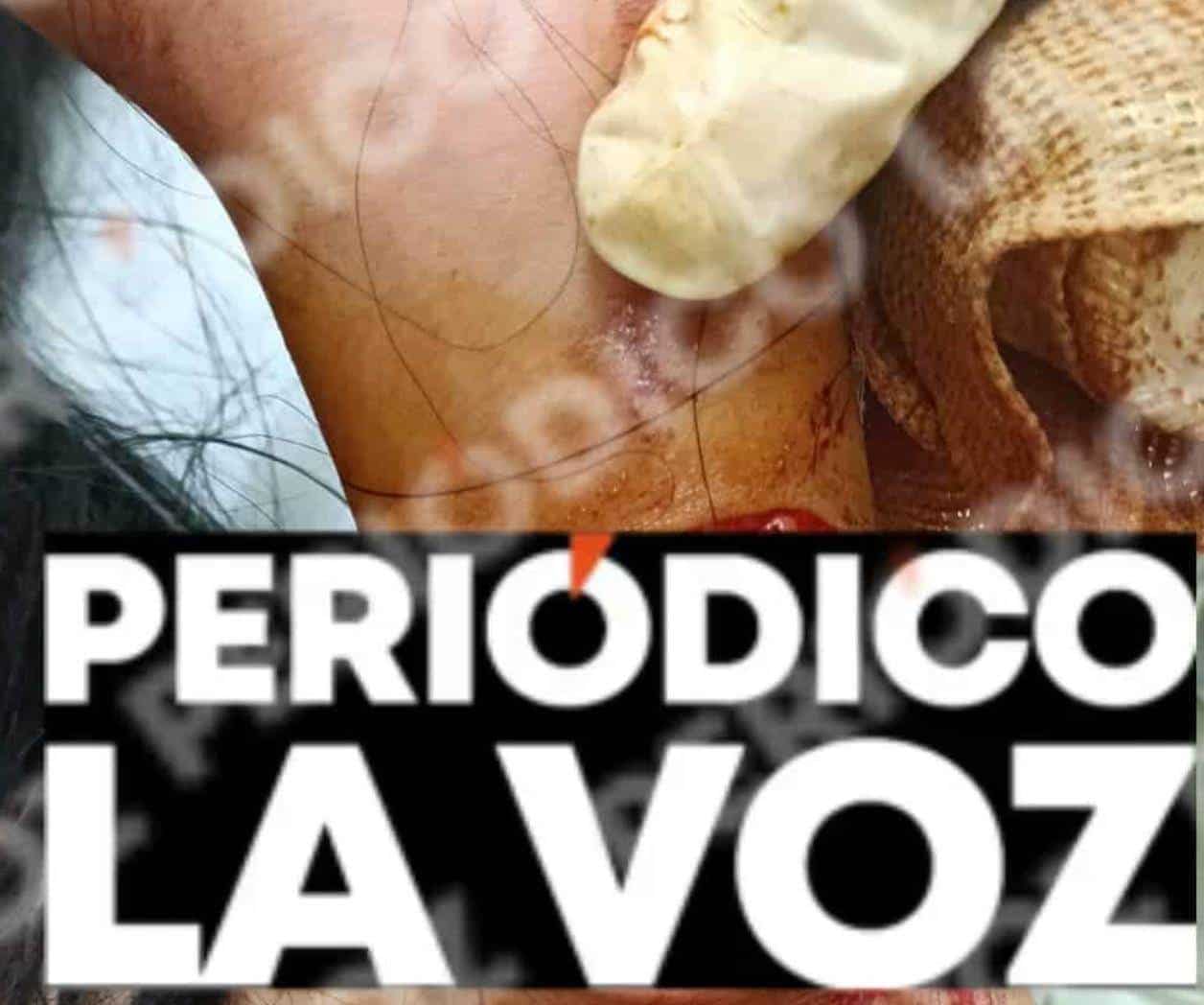 Las adolescentes fueron aseguradas por la Policía Municipal después del enfrentamiento registrado en la colonia Otilio Montaño.