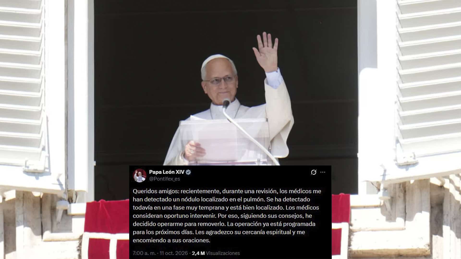 Papa Le&oacute;n XIV anuncia cirug&iacute;a por n&oacute;dulo pulmonar